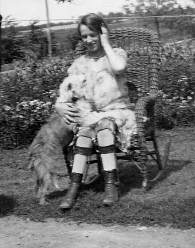 Women Polio Leg Braces